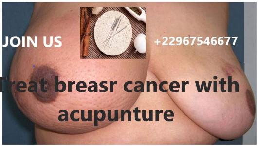 Breast Cancer without surgery