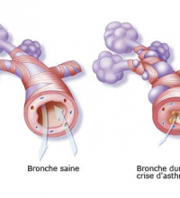 bronches-et-asthme.png