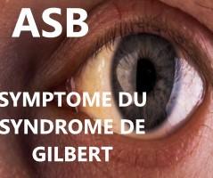 Tisane naturelle contre le syndrome de Gilbert