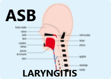 Laryngitis: definition, symptoms,cause and natural treatment