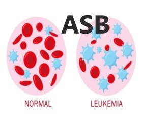 Leukemia