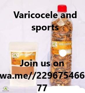 Varicocele veins and sport