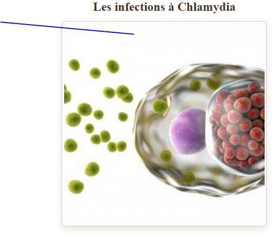 Infection a chlamydia 1